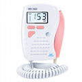 Fetal Doppler，Baby Heartbeat Monitor for Pregnancy Small and Convenient 1