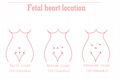 Doppler Fetal Heart Rate Monitor,Baby Heartbeat Monitor