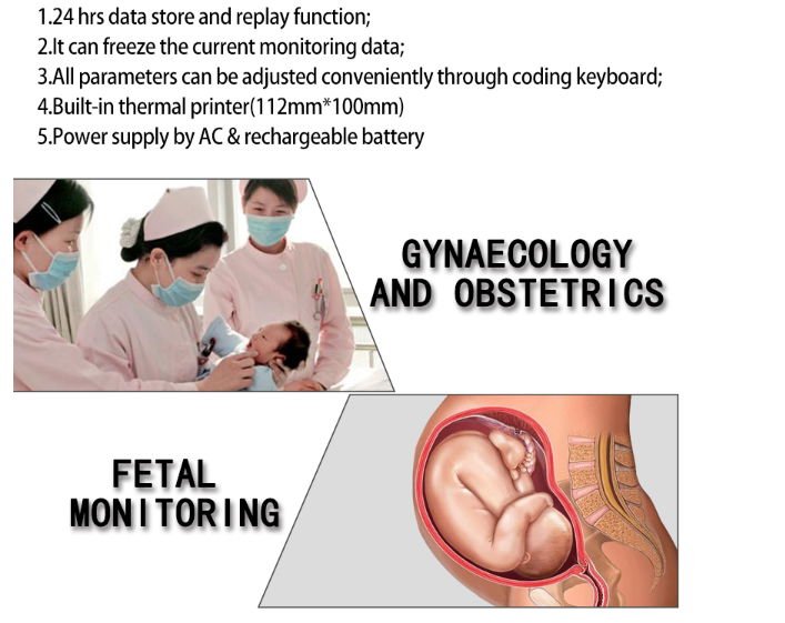 Doppler Fetal Heart Rate Monitor and Baby Announcement 4