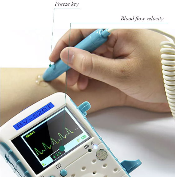 BSM CE bidireccional 8mhz probeTFT  Vascular Doppler BV-520T  4