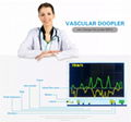 Handheld Vascular doppler BV-520T+ ,Colorful Waveform TFT Screen PC Software 4