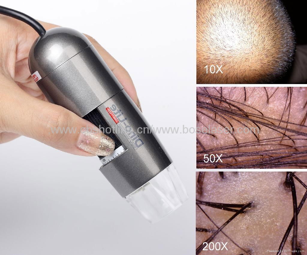 Scalp Camera（For hair transplanting ） 2