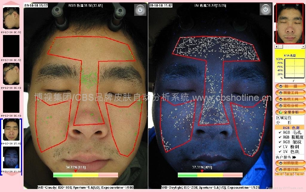 Magic Mirror Facial Skin Analysis  5