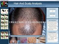Hair and Scalp analysis system  2
