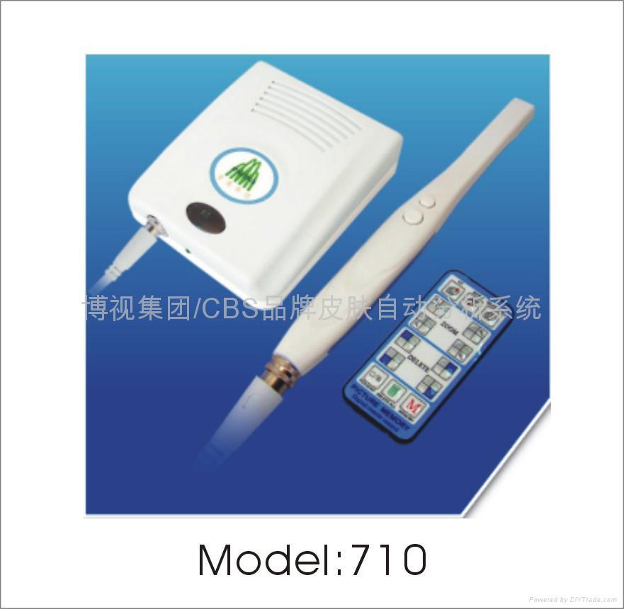 710 Wire USB intra-oral camera