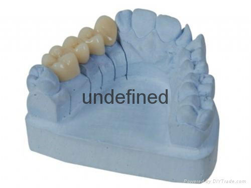 Dental Zirconia crown 3