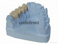 Dental Zirconia crown