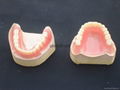 Dental Removable Partial Acrylic Resin Denture