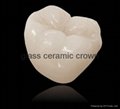 Dental glass ceramic crown
