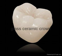Dental glass ceramic crown