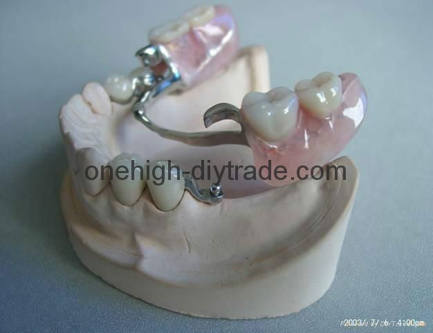 Dental Attachment