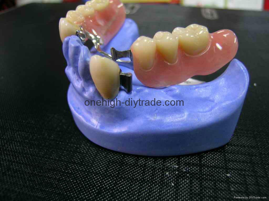 Dental Attachment 2