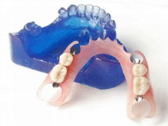 Dental Removable Partial Acrylic Resin Denture