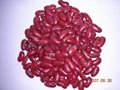 Dark english kidney beans