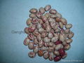 light speckled kidney beans 