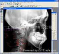 頭影測量分析正畸軟件WinCeph 8.0