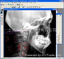 头影测量分析正畸软件WinCeph 8.0