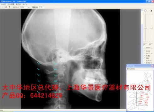 WinCeph 9头影测量分析应用软件网络版