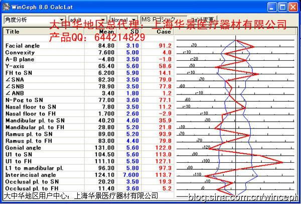 WinCeph 9头影测量分析应用软件网络版 4