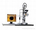 digital slit lamp microscope