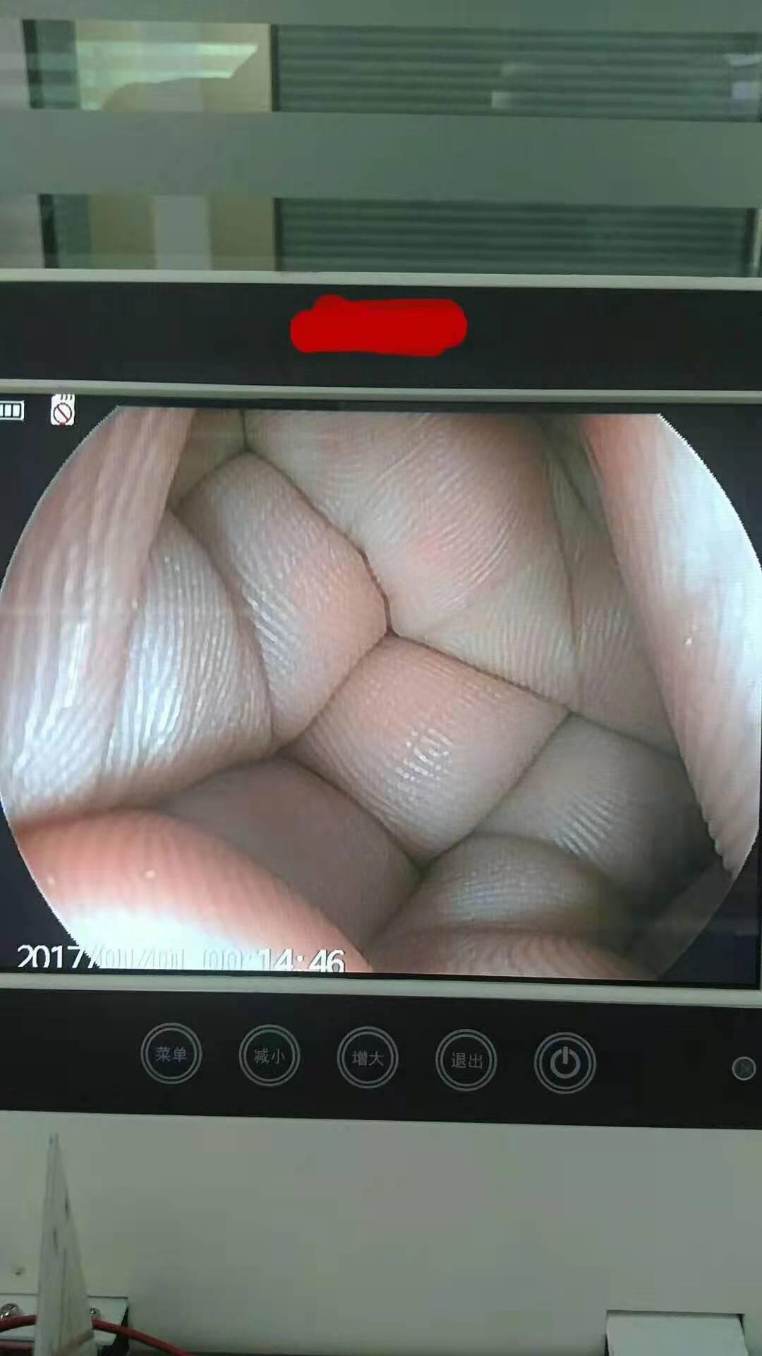 廠家直供高清內窺鏡主機方案 4