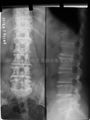 portable and high frequency medical diagnosis x-ray unit 5