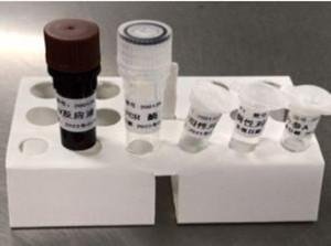 2019-Novel Coronavirus (2019-nCoV) RT-PCR Detection Kit 
