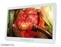 ECONT-0501.3 26" HD Surgical display