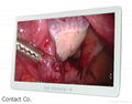 ECONT-0501.4 27" HD Surgical display