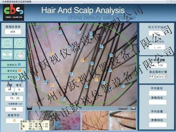 Computer detector Hair | smart hair analysis instrument | hair diagnostic 5