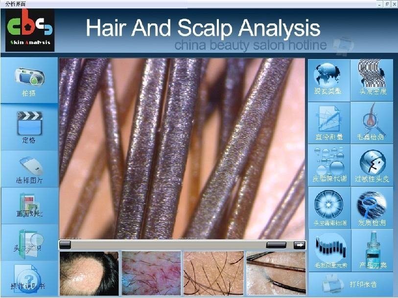 hair follicle analyzer | 500 times the hair follicle detector 2