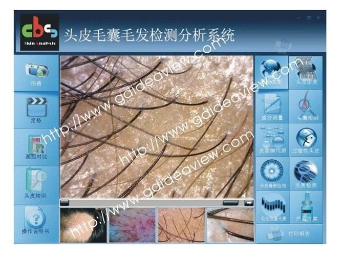 Hair Analysis System Vertical Touch-one diagnostic definition hair analysis 4
