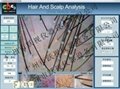 Hair Analysis System Vertical Touch-one diagnostic definition hair analysis 5
