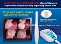 200 million pixels SONY CCD VGA + USB intraoral camera 2
