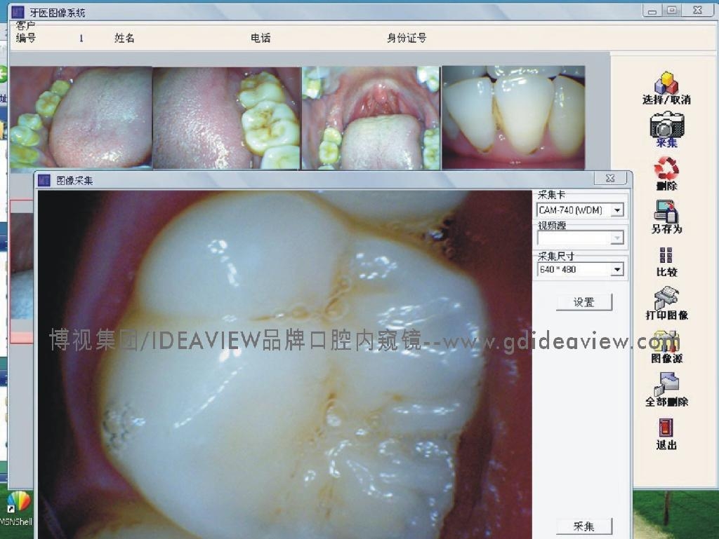 130萬像素CMOS家用型USB口腔內窺鏡 4