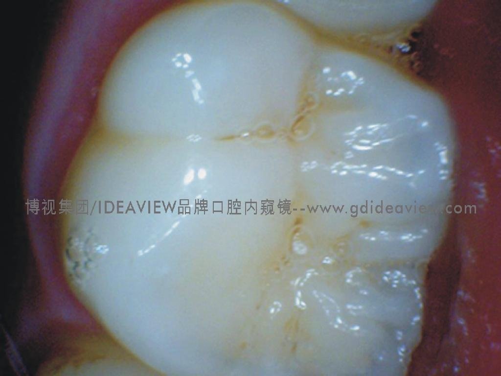 Mini dental intra-oral Camera  5