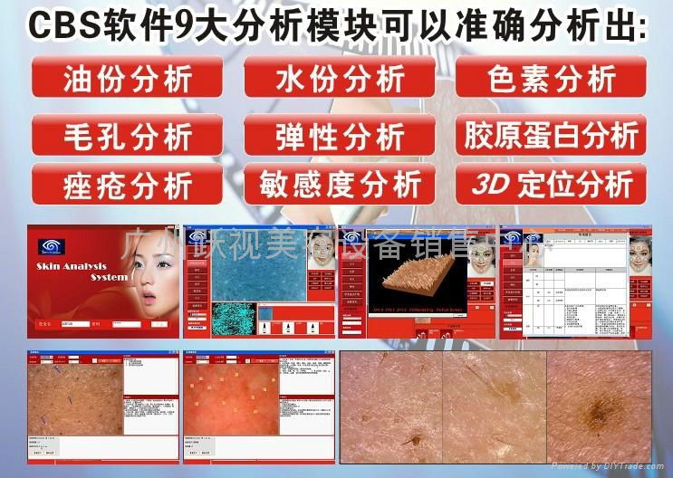 Taiwan intelligent skin detection instrument 5