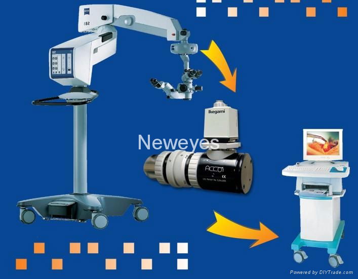 digital conversion of operation microscope