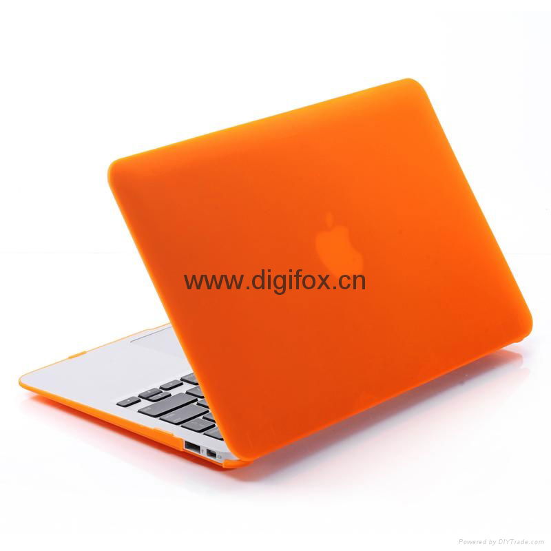 Protective Hard Shell Case for Macbook Air,Macbook Pro,Pro Retina,Etc 5