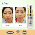 E126 Instant Face Reshaper 4