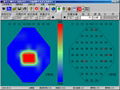 APS-6000B Automatic Perimeter  5