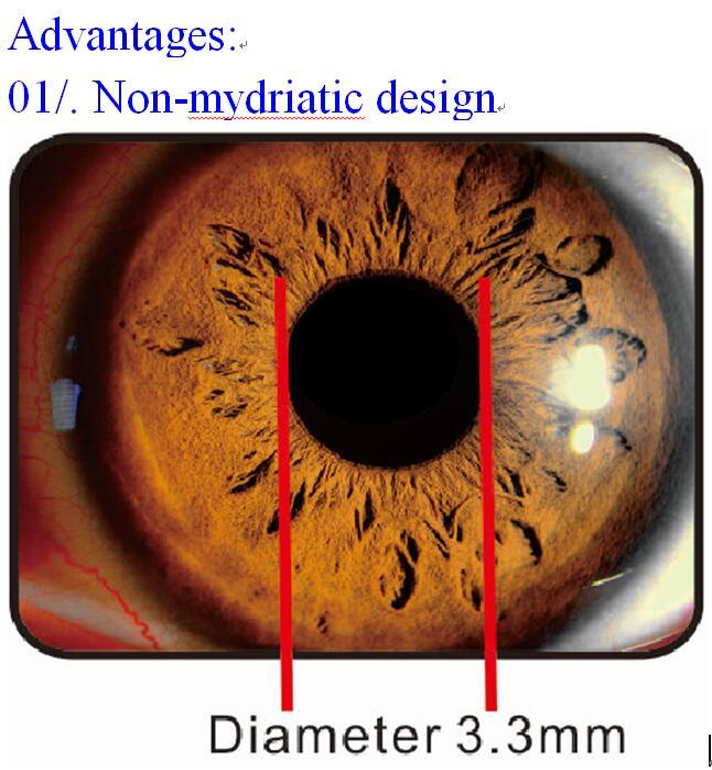 APS-DER Full automated Fundus Camera (Retina Camera Serial) 2