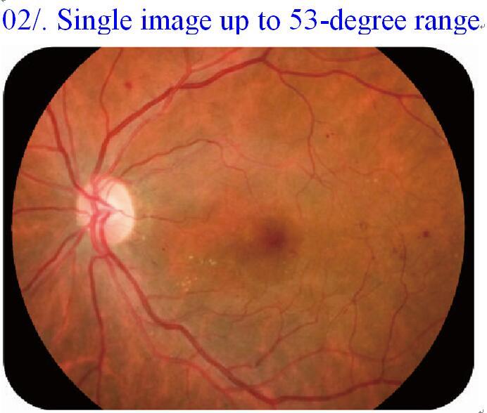 APS-DER Full automated Fundus Camera (Retina Camera Serial) 3