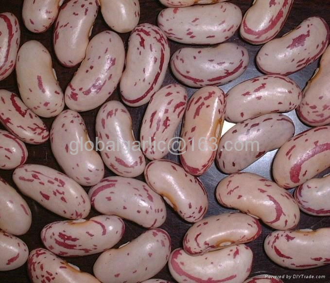 light speckled Kidney beans