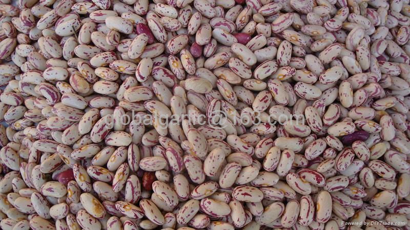 light speckled Kidney beans 2