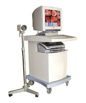 Electronic colposcope