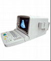 Portable Convex Ultrasound Scanner  1