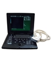 Palmsize Ultrasound Scanner