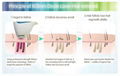 808半导体无痛激光脱毛仪 3
