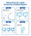 肠疗仪 清肠仪 水疗仪 熵碱仪 肠疗仪导管 肠疗机厂家直营